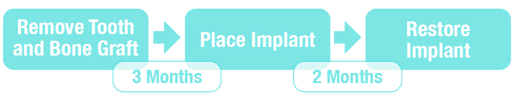 A blue sign with the words " place implant ".