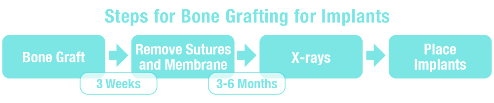 A graphic showing the process of grafting an image.